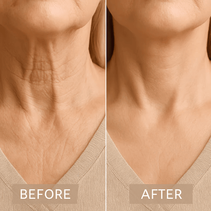 Set 20Pc Neck Lifting Tape - Instant Firming & Sculpting Effect - Invisible & Skin-Safe Adhesive 15170501607750-1