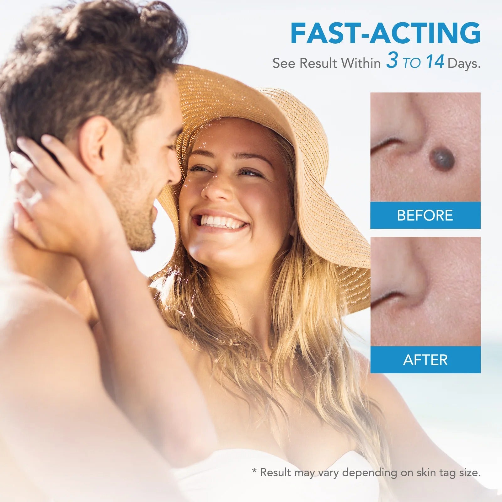2-In-1 Skin Tag And Mole Remover Kit 339068