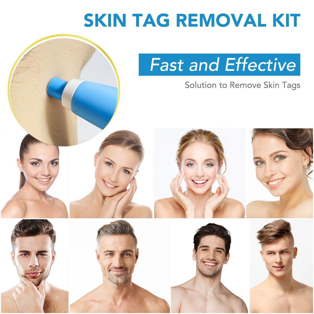 2-In-1 Skin Tag And Mole Remover Kit 339068