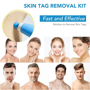 2-In-1 Skin Tag And Mole Remover Kit