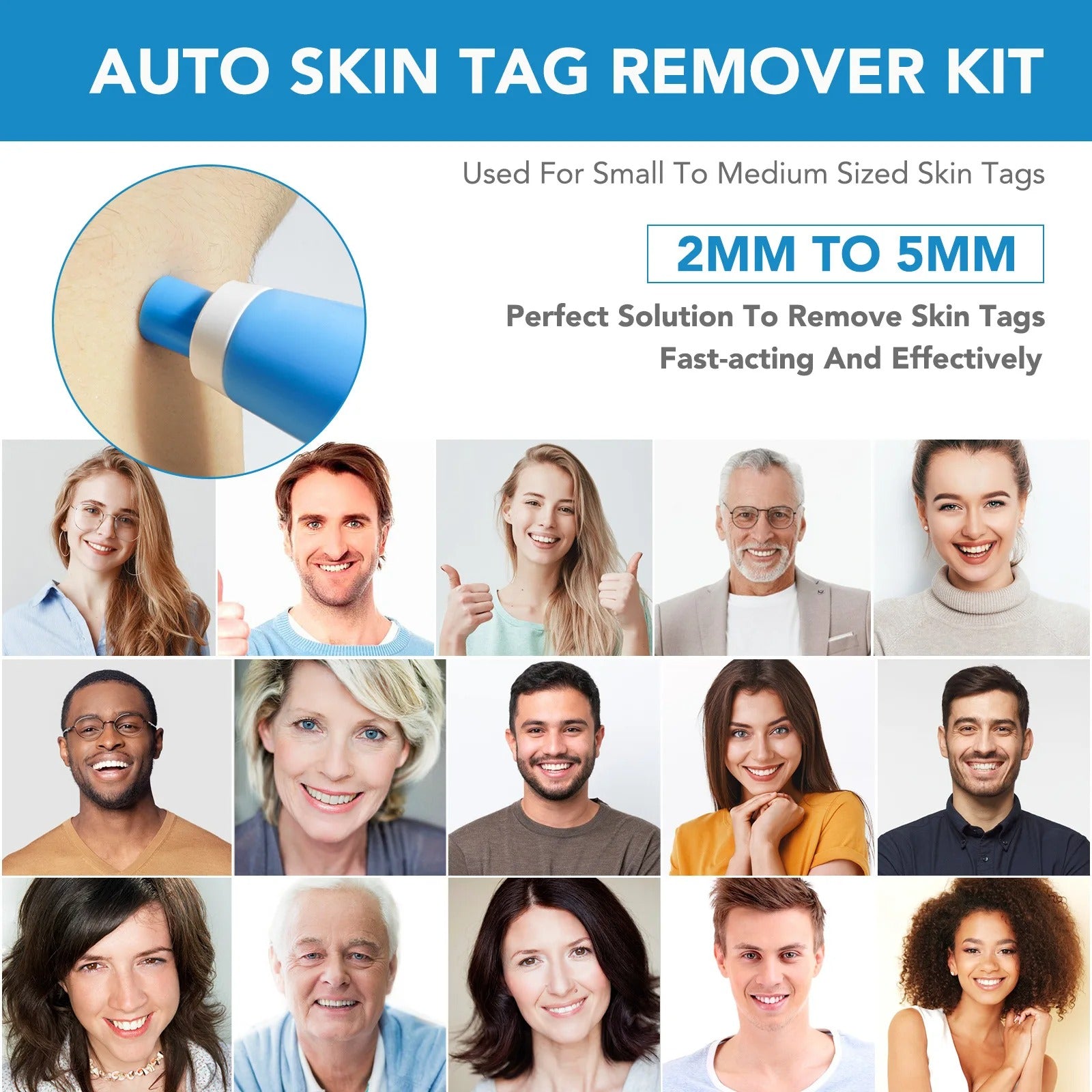 2-In-1 Skin Tag And Mole Remover Kit