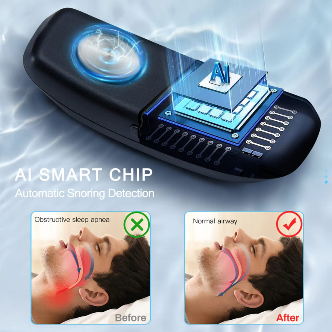 EMS Anti-Snore Device Muscle Stimulator - Smart Snore Stopper 1005007539710937-al