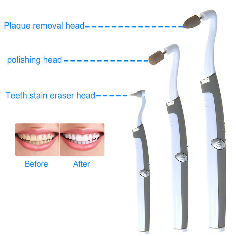 Sonic Tooth Stain Remover - Plaque Removal Tool For Teeth At Home