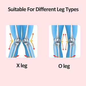 1Pcs Adjustable O/X Type Legs Correction Band