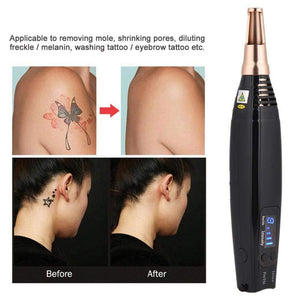 Professional Tattoo Removal Laser Picosecond Pen