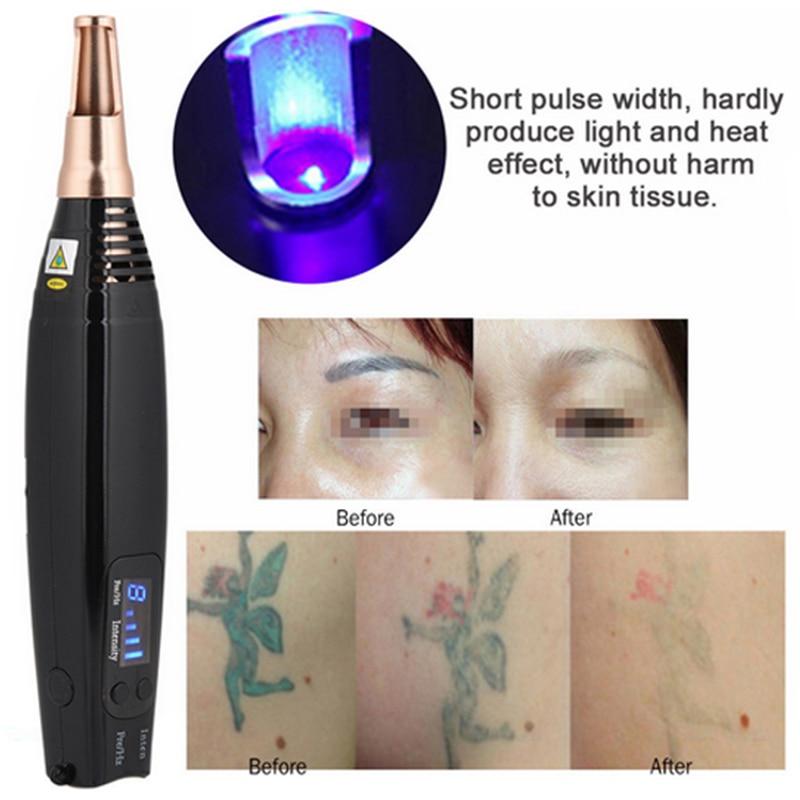 Professional Tattoo Removal Laser Picosecond Pen