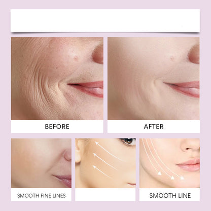 Invisible Lifting Tape Defines Facial Contours Creating Firmer Appearance Throughout Wear 8719079047410-1