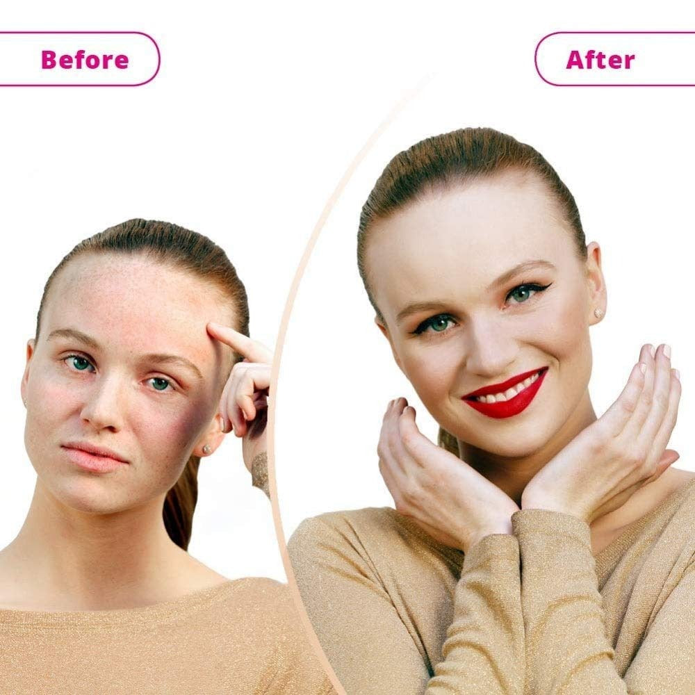 Waterproof Full Coverage Concealer for Dark Spots, Sensitive, Blemishes Skin 263364