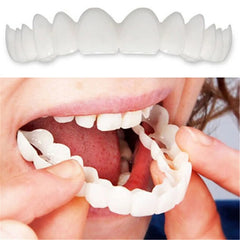 Temporary Custom Mold for Stained or Missing Teeth