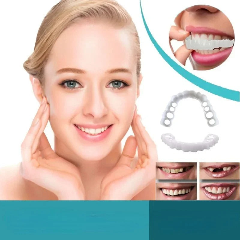 Temporary Custom Mold for Stained or Missing Teeth 252138