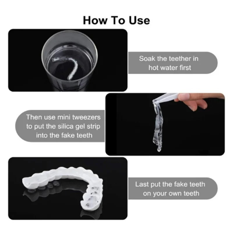 Temporary Custom Mold for Stained or Missing Teeth 252138