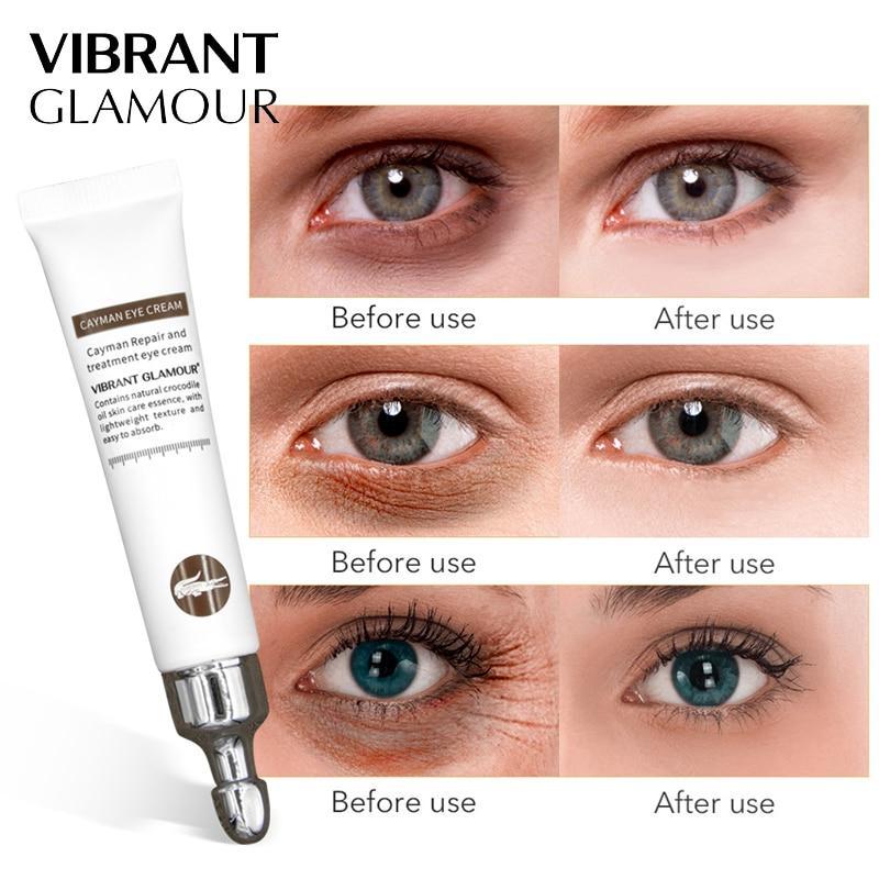 Magic Eye Cream - Eye Bag &Amp; Wrinkle Remover (20G)