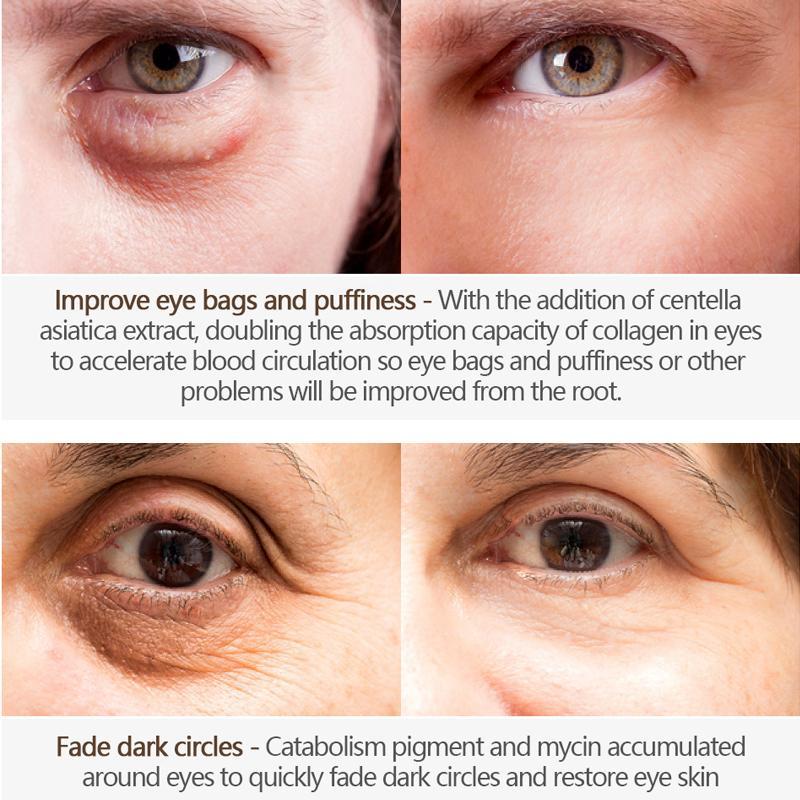 Moisturising Eye Cream for Dark Circles Wrinkles Collagen Repair Puffy Eyes 248903