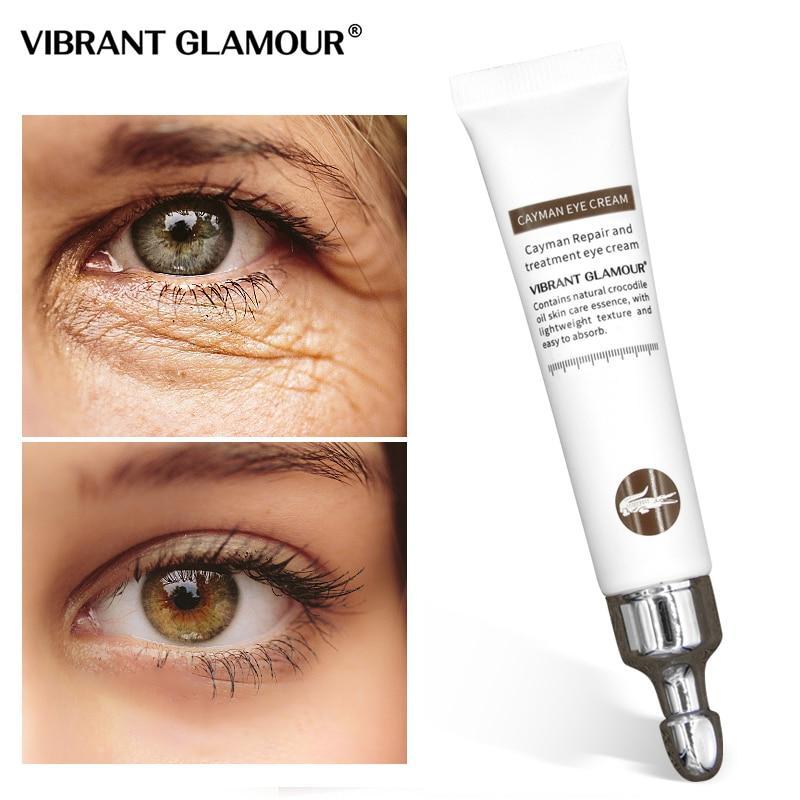 Magic Eye Cream - Eye Bag &Amp; Wrinkle Remover (20G)