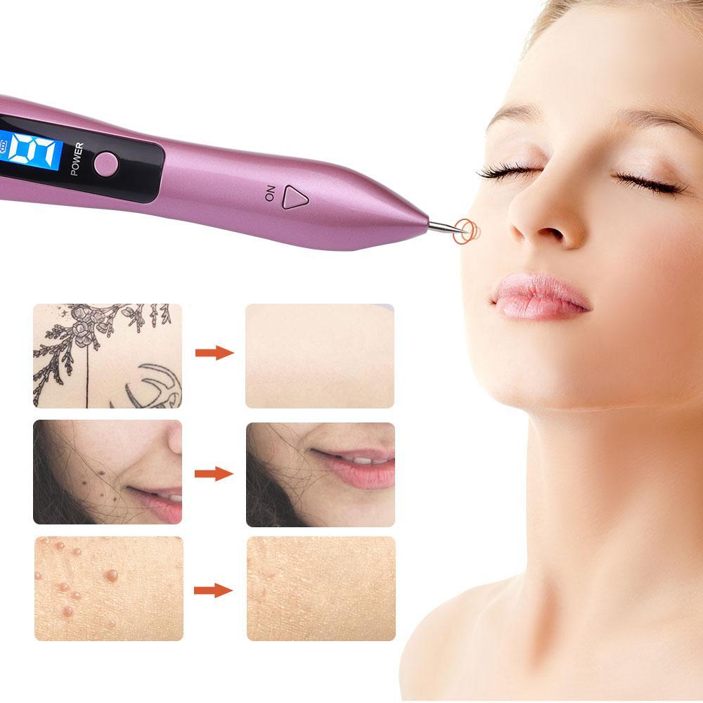 Skin Tag And Mole Remover