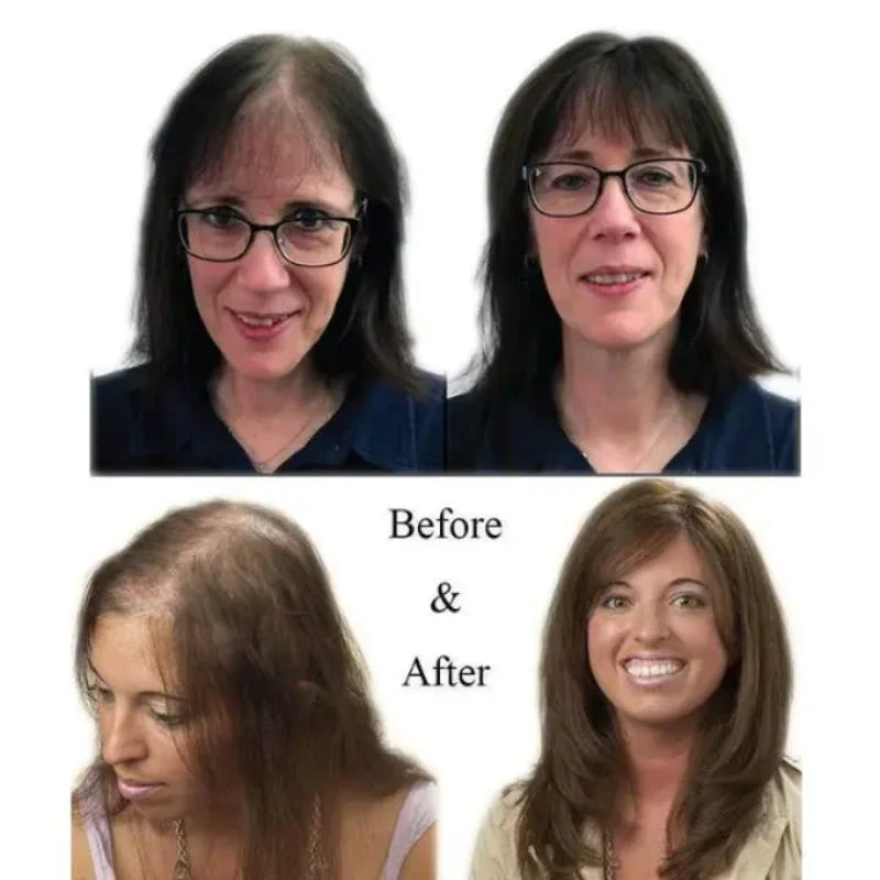 Hair Toppers for Women Volume Wig Clip Loss Cover