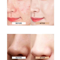 Waterproof Full Coverage Concealer for Dark Spots, Sensitive, Blemishes Skin