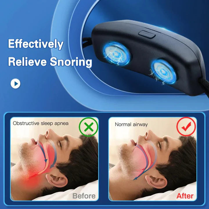 Comfortable Anti-Snore Device For Sleep Apnea Relief