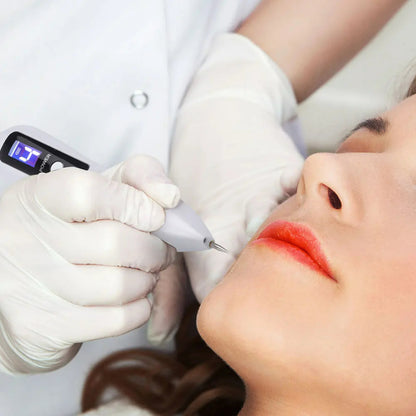 LCD Plasma Laser Pen – Portable Remover for Skin Tags, Freckles, Melasma & Tattoos 258119