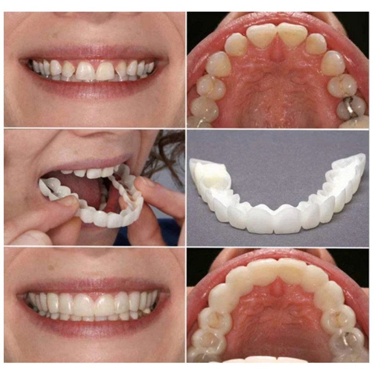 Dental Aligner For Whitening Teeth And Invisible Orthodontic Comfort 8409567821955-1
