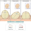 Pillow Head Shaping Prevent Flat Head For Newborn3