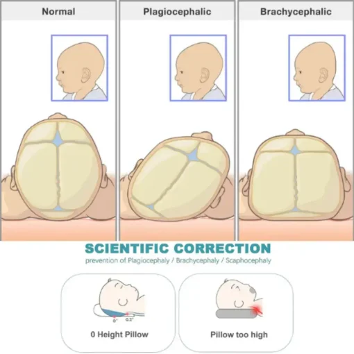 Pillow Head Shaping Prevent Flat Head For Newborn3