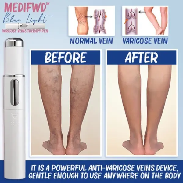 Medifwd Blue Light Therapy Varicose Veins Pen1