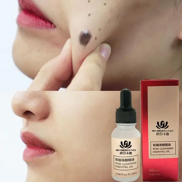 Organic Skin Tag Removal Serum5