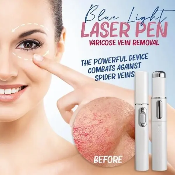 Spider Veins Removal Pen2