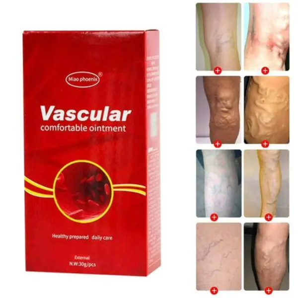 Varicose Veins Removal Cream4