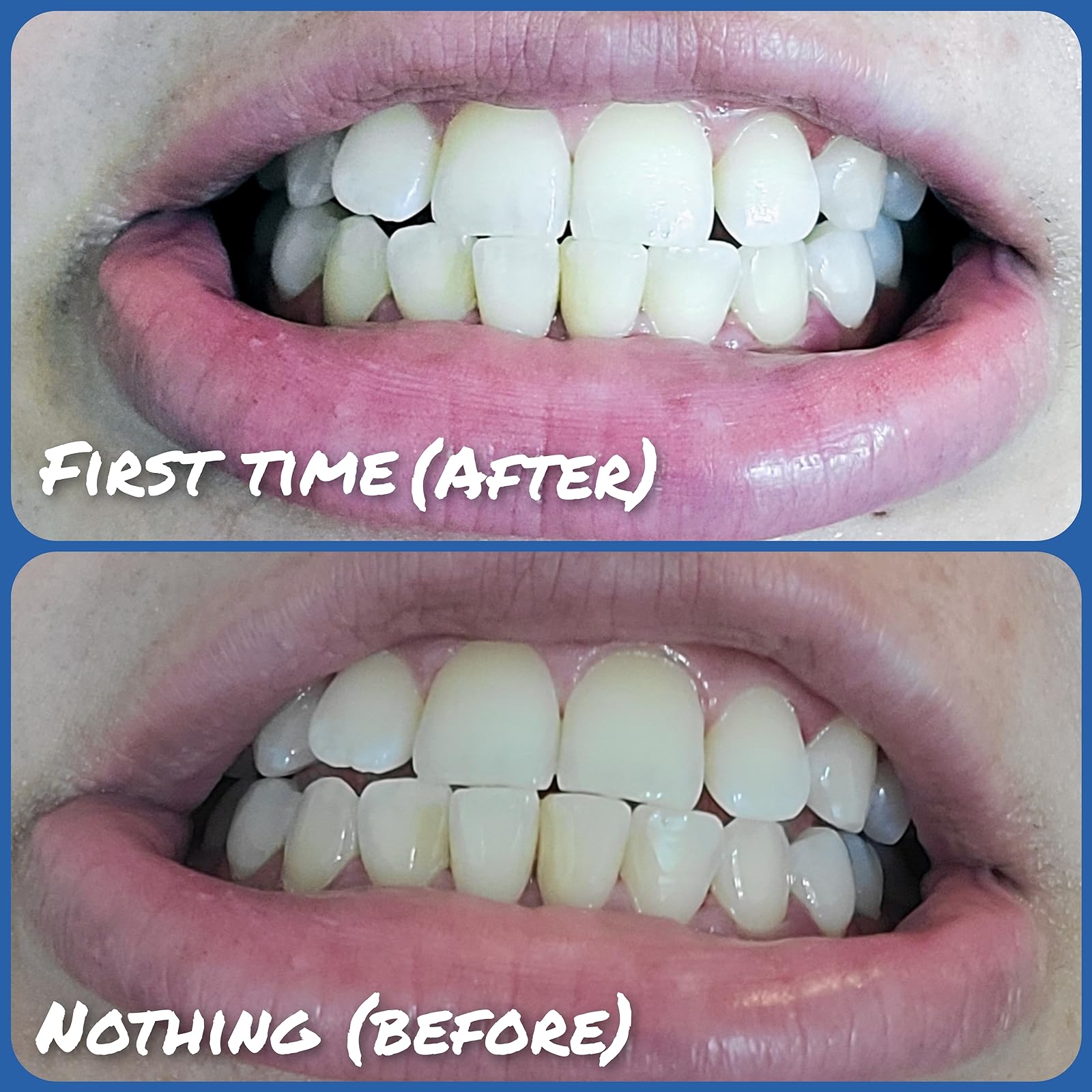 Intensive Stain Removal Whitening Toothpaste photo review