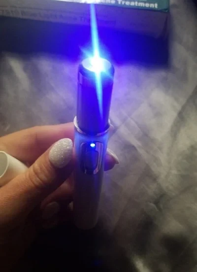 Spider Veins Removal Pen photo review